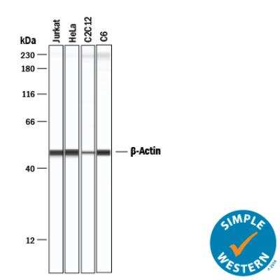 Simple Western: Loading Control (Simple Western) Antibody Pack [NBP3-06858]