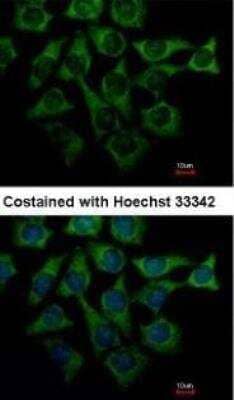 Immunocytochemistry/ Immunofluorescence: Loricrin Antibody [NBP1-33610]