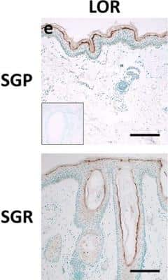 Immunohistochemistry: Loricrin Antibody [NBP1-33610]