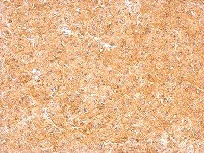 Immunohistochemistry-Paraffin: Loricrin Antibody [NBP1-33610]