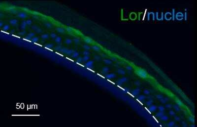 Immunohistochemistry-Paraffin: Loricrin Antibody [NBP1-33610]