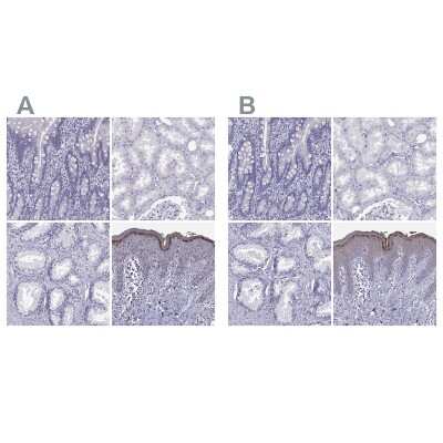 Immunohistochemistry-Paraffin: Loricrin Antibody [NBP2-62700]