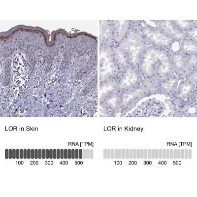 Immunohistochemistry-Paraffin: Loricrin Antibody [NBP2-62700]