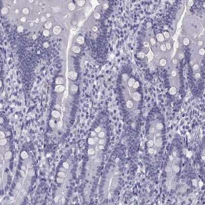 Immunohistochemistry-Paraffin: Loricrin Antibody [NBP2-62700]