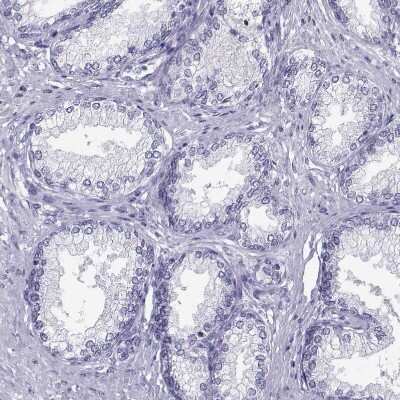Immunohistochemistry-Paraffin: Loricrin Antibody [NBP2-62700]