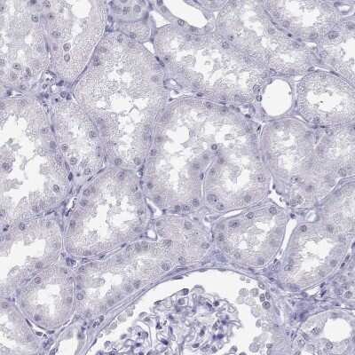 Immunohistochemistry-Paraffin: Loricrin Antibody [NBP2-62700]