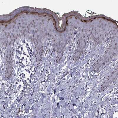 Immunohistochemistry-Paraffin: Loricrin Antibody [NBP2-62700]