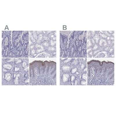 Immunohistochemistry-Paraffin: Loricrin Antibody [NBP2-62716]