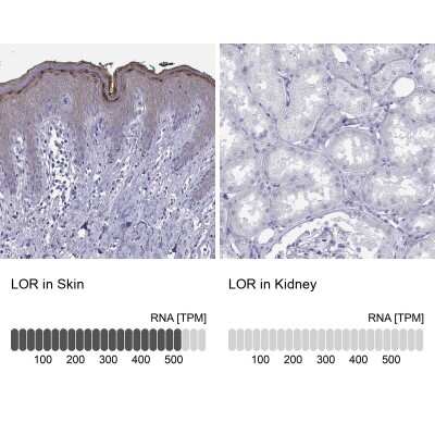 Immunohistochemistry-Paraffin: Loricrin Antibody [NBP2-62716]