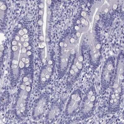Immunohistochemistry-Paraffin: Loricrin Antibody [NBP2-62716]