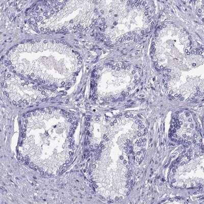 Immunohistochemistry-Paraffin: Loricrin Antibody [NBP2-62716]