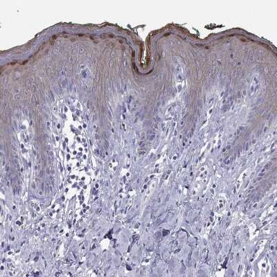 Immunohistochemistry-Paraffin: Loricrin Antibody [NBP2-62716]