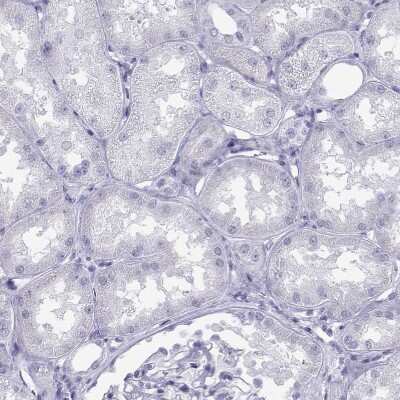 Immunohistochemistry-Paraffin: Loricrin Antibody [NBP2-62716]