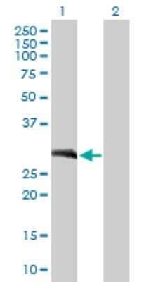 Western Blot: Loricrin Antibody [H00004014-B01P]