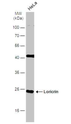 Western Blot: Loricrin Antibody [NBP1-33610]