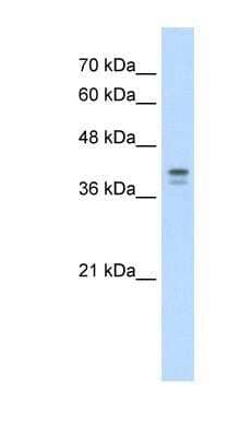 Western Blot: Loricrin Antibody [NBP1-55127]