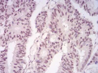 Immunohistochemistry-Paraffin: LRP-1 Antibody (1C8G6) - BSA Free [NBP2-52506]