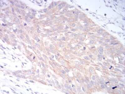 Immunohistochemistry: LRP-1 Antibody (3F12E2) - BSA Free [NBP2-52505]