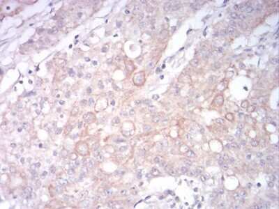 Immunohistochemistry: LRP-1 Antibody (3F12E2) - BSA Free [NBP2-52505]