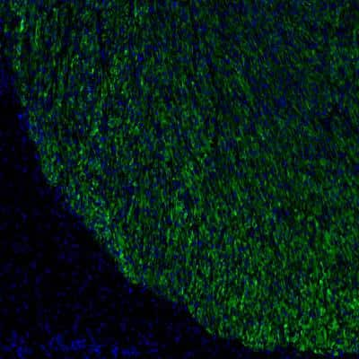 Immunohistochemical Analysis of Luciferase in Human Tumor Xenograft