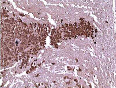 Immunohistochemical Detection of Luciferase in Paraffin Embedded Mouse Brain Tissue