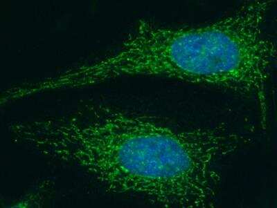 Immunocytochemistry/ Immunofluorescence: Lumican Antibody (077) [NBP2-89941]