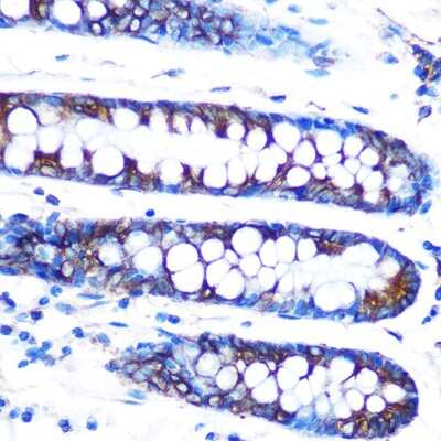Immunohistochemistry-Paraffin: Lumican Antibody (4Z2C1) [NBP3-15408]