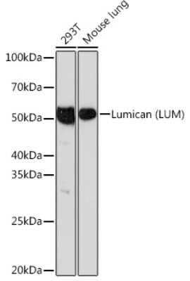 Western Blot: Lumican Antibody (4Z2C1) [NBP3-15408]