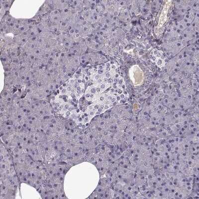 Immunohistochemistry-Paraffin: Lumican Antibody [NBP1-87726]