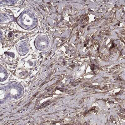 Immunohistochemistry-Paraffin: Lumican Antibody [NBP1-87726]