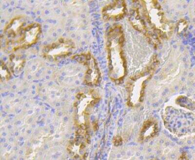 Immunohistochemistry: Lumican Antibody (JE11-45) [NBP2-76847]