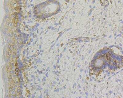 Immunohistochemistry: Lumican Antibody (JE11-45) [NBP2-76847]
