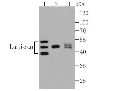 Western Blot: Lumican Antibody (JE11-45) [NBP2-76847]