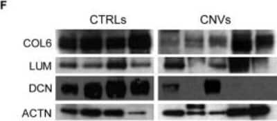 Western Blot: Lumican Antibody [NBP1-87726]