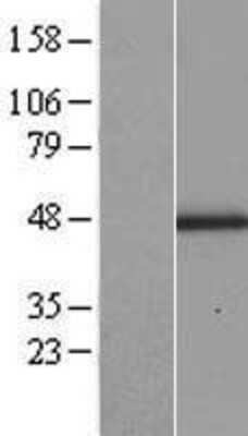 Western Blot: Lumican Overexpression Lysate [NBP2-10821]