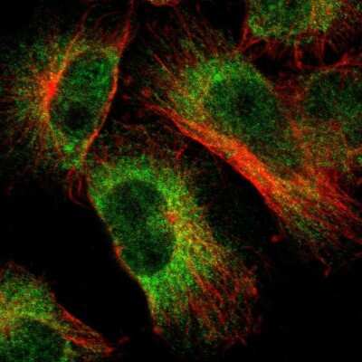 Immunocytochemistry/ Immunofluorescence: Lunapark Antibody [NBP1-80637]