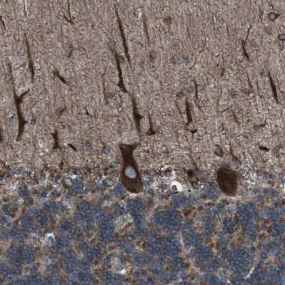 Immunohistochemistry-Paraffin: Lunapark Antibody [NBP1-80637]