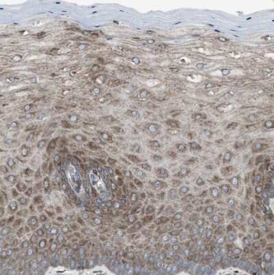 Immunohistochemistry-Paraffin: Lunapark Antibody [NBP1-80637]