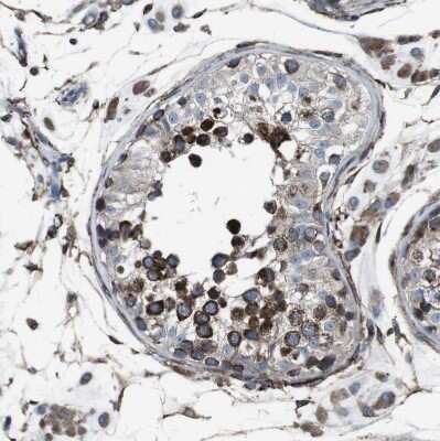 Immunohistochemistry-Paraffin: Lunapark Antibody [NBP1-80637]