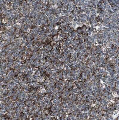 Immunohistochemistry-Paraffin: Lunapark Antibody [NBP1-80637]