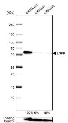 Western Blot: Lunapark Antibody [NBP1-80637]