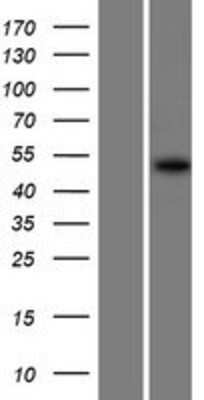 Western Blot: Lunapark Overexpression Lysate [NBP2-06199]