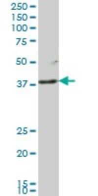 Western Blot: Lunatic Fringe Antibody (1F9) [H00003955-M03]