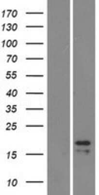 Western Blot: LH beta Overexpression Lysate [NBP2-10716]