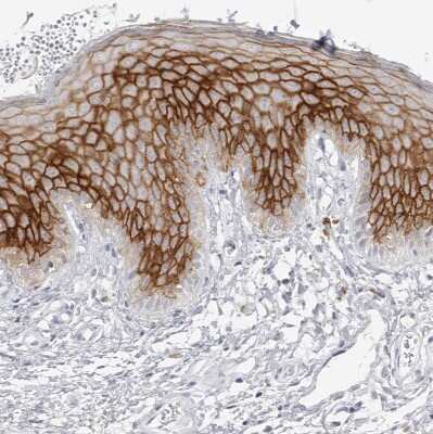 Immunohistochemistry-Paraffin: Ly-6D Antibody [NBP1-84029]