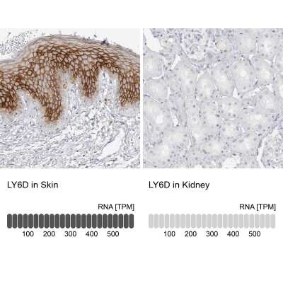 Immunohistochemistry-Paraffin: Ly-6D Antibody [NBP1-84029]