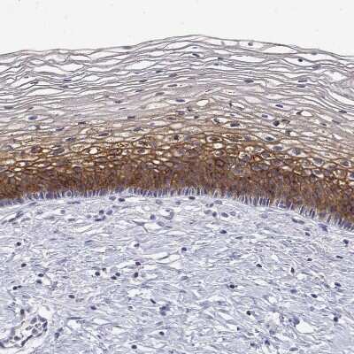 Immunohistochemistry-Paraffin: Ly-6D Antibody [NBP2-49416]
