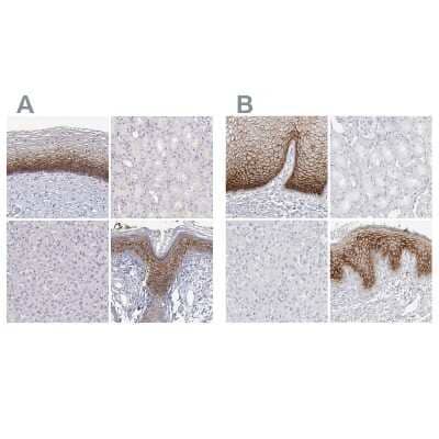 Immunohistochemistry-Paraffin: Ly-6D Antibody [NBP2-49416]