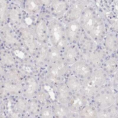 Immunohistochemistry-Paraffin: Ly-6D Antibody [NBP2-49416]