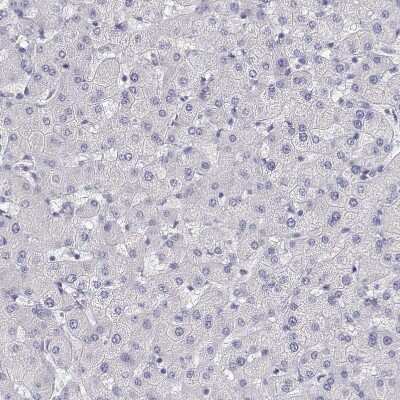 Immunohistochemistry-Paraffin: Ly-6D Antibody [NBP2-49416]